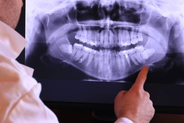 Best Urgent Dental Care for Toothache in Shepherd, TX