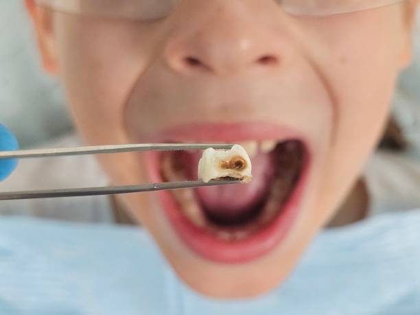 Best 24-Hour Emergency Dentist in Shepherd, TX